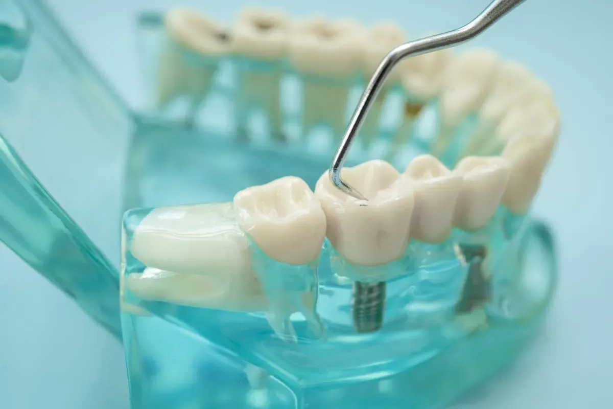 Comprehensive Guide to Restorative Dentistry