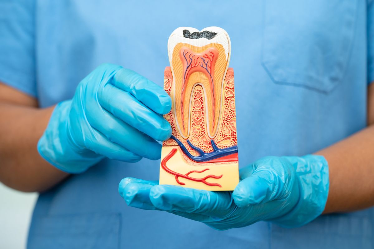 root canal recovery tips