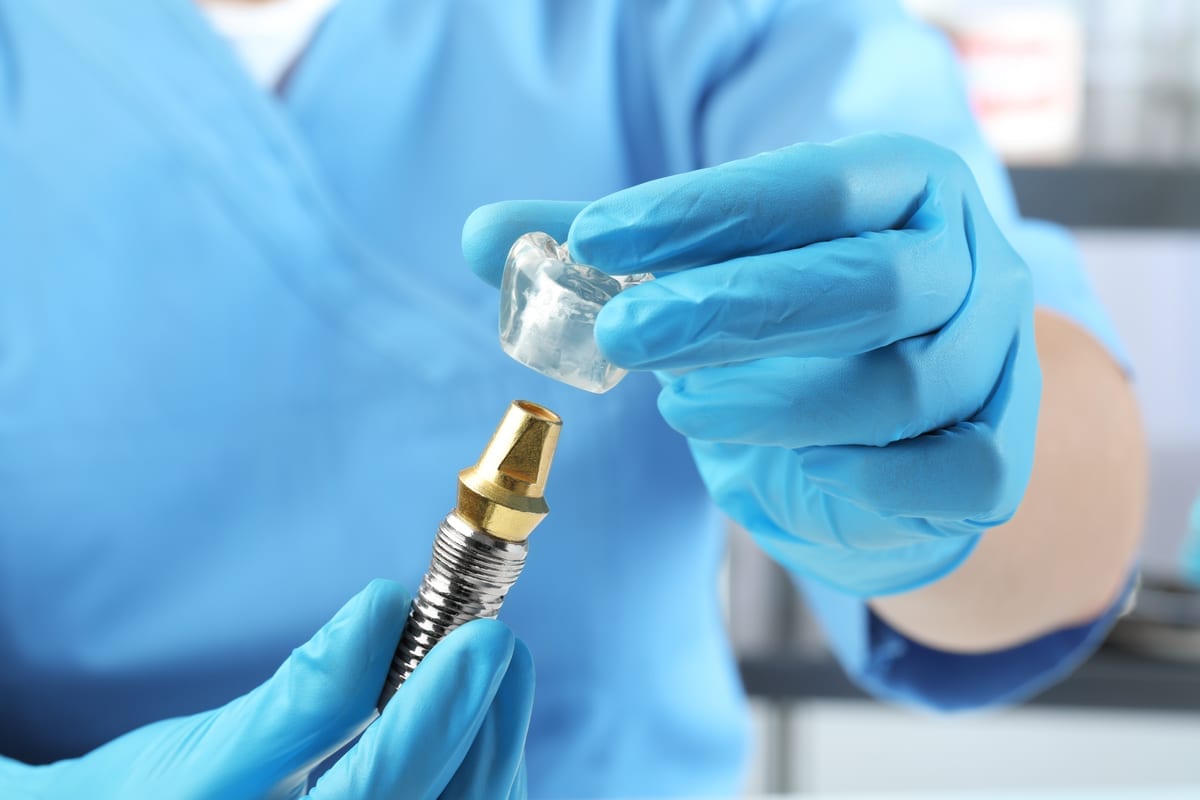 Dental Implants in Haymarket