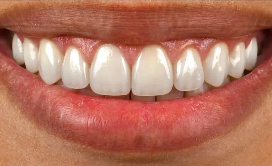 cosmetic dentistry smile after