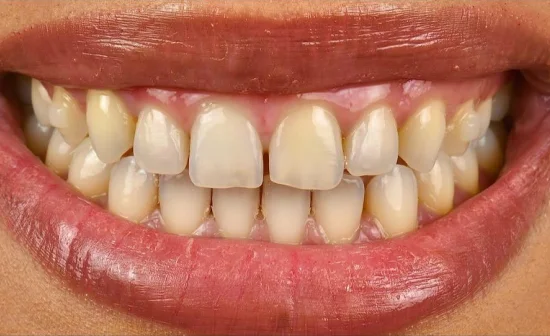 cosmetic dentistry smile before