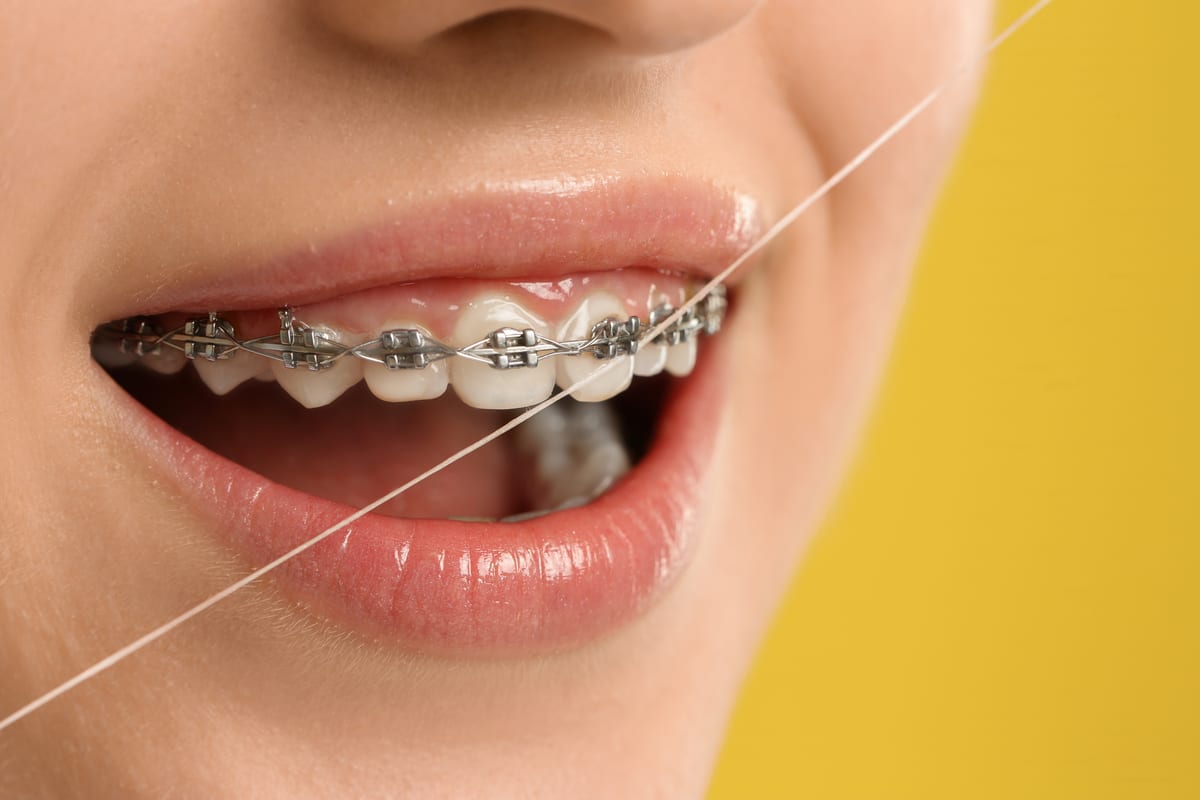 Orthodontics in Haymarket