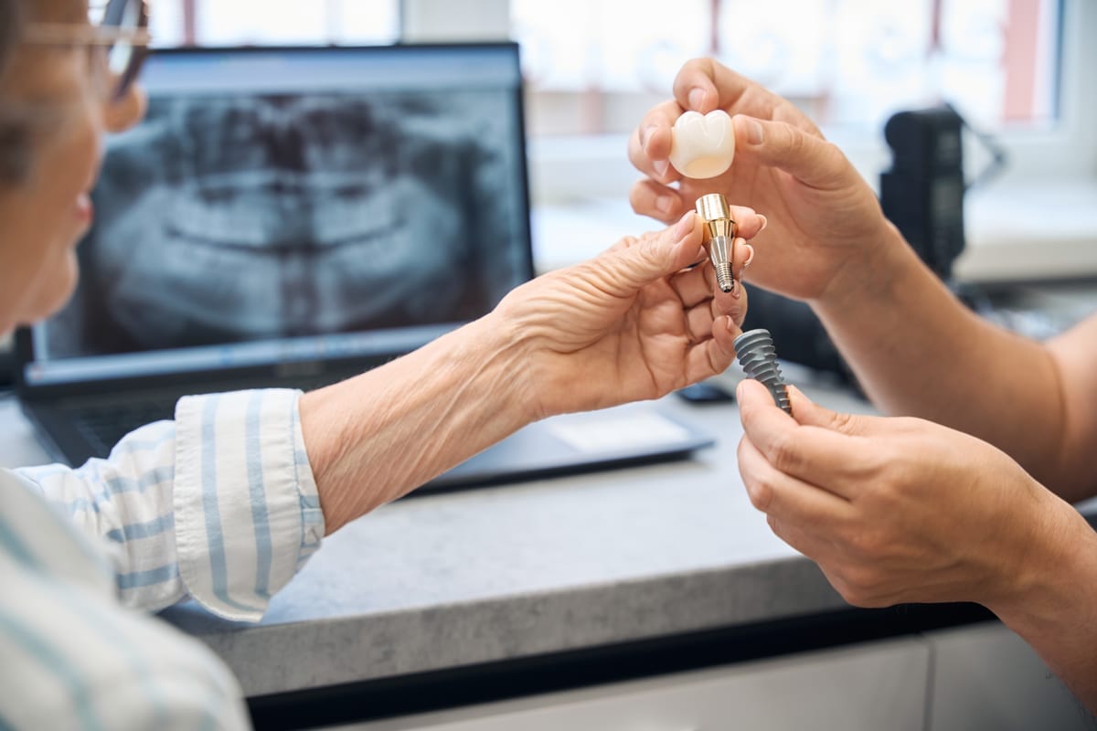 Dental Implants in Haymarket